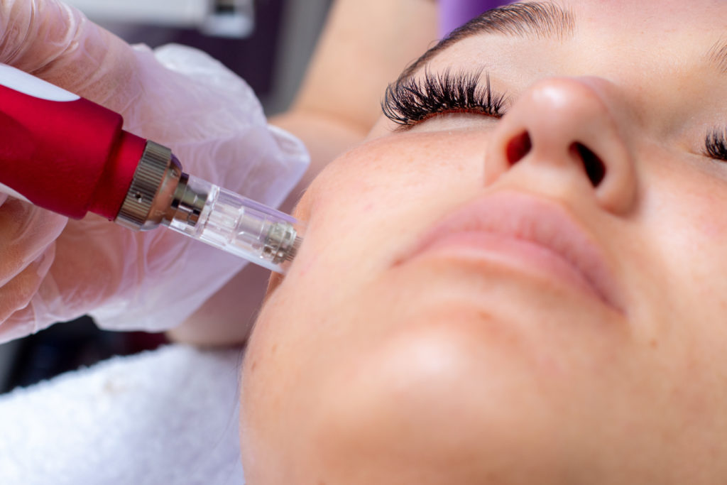 Benefits And Side Effects Of Microneedling | Sevid Beauty