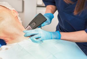 Morpheus8 Treatments