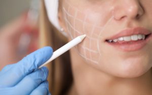 What Are Fillers And How Do They Work