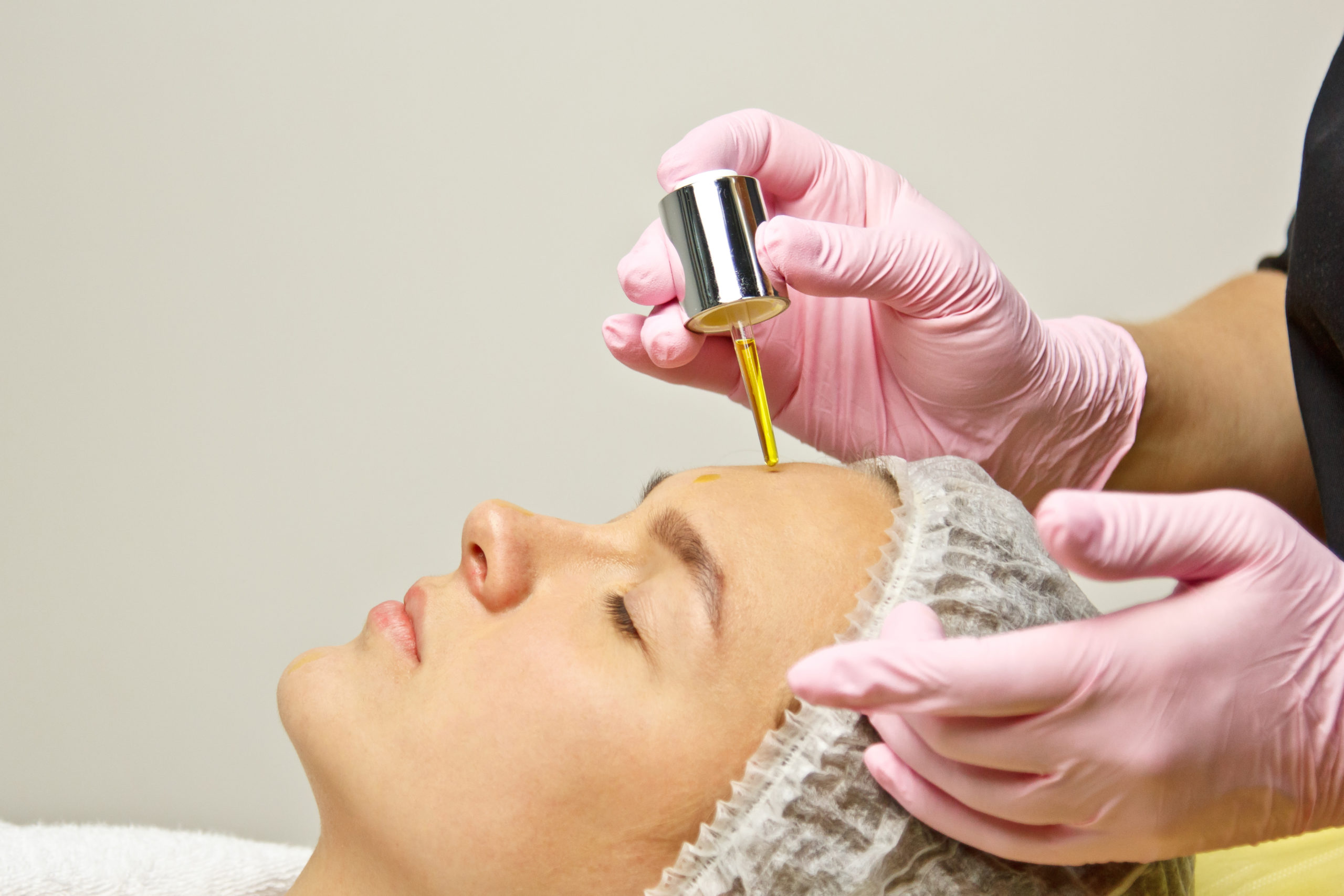 Kybella: Say Goodbye to Double Chin